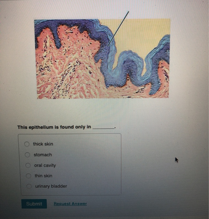 Muscularis mucosa bladder image