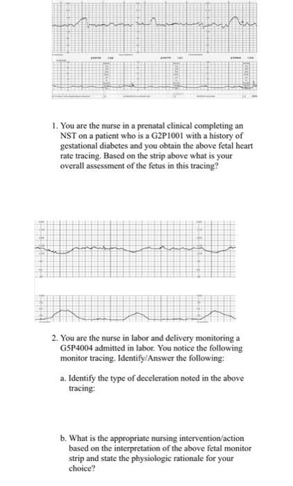 Solved 1. You are the nurse in a prenatal clinical | Chegg.com