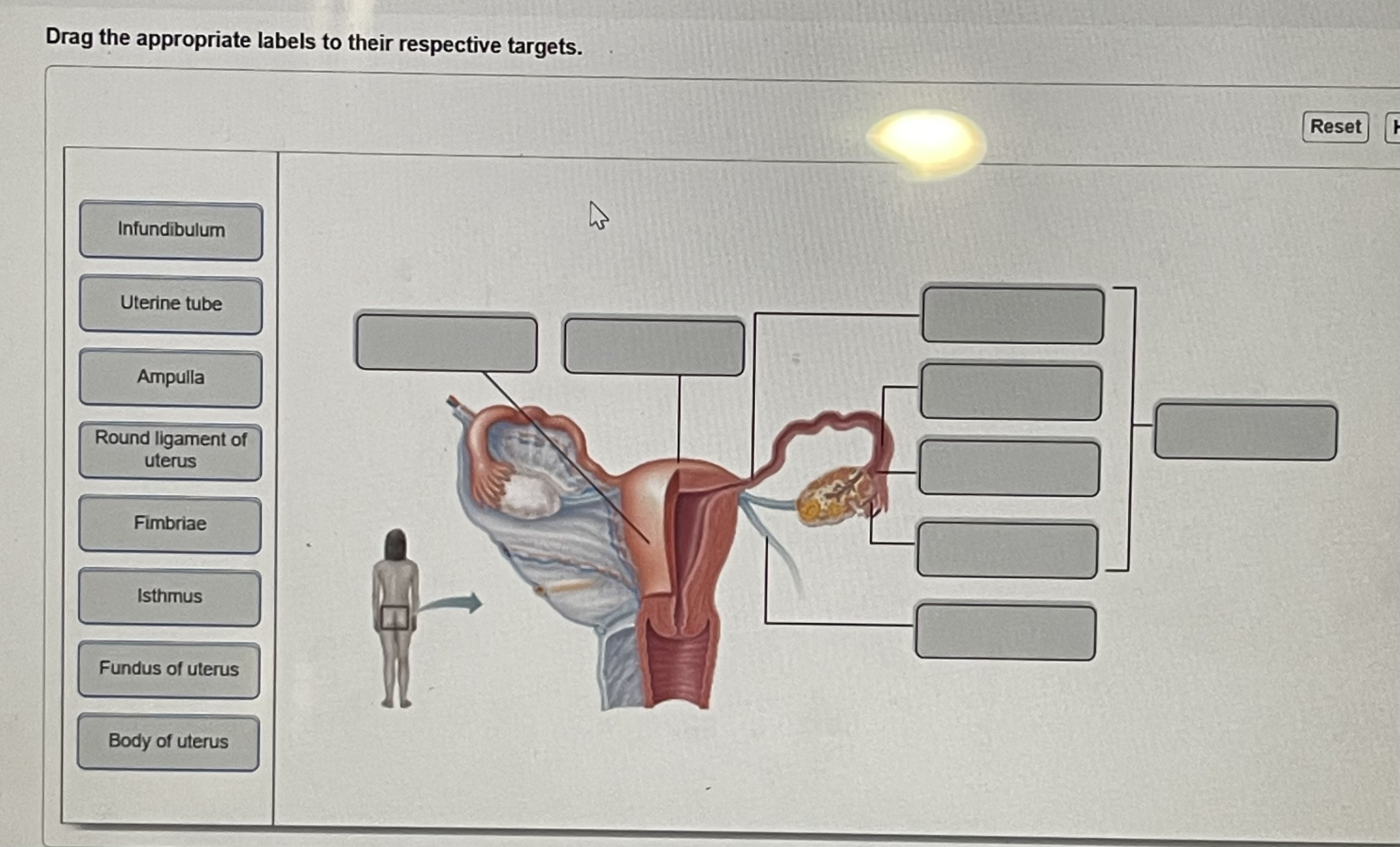Dedrag The Appropriate Labels To Their Respective Targets. Chegg - h959g4r