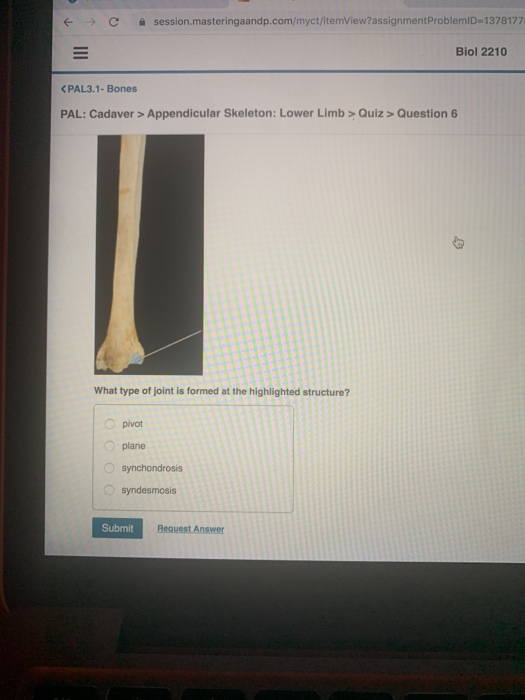 Appendicular Skeleton: Joints > Quiz > Question 2 ... | Chegg.com