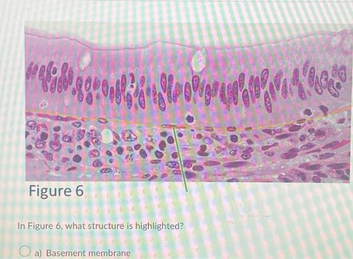 Solved In Figure 6, what structure is highlighted? a) | Chegg.com