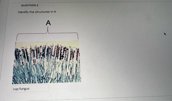 Solved Identify The Structures In A | Chegg.com