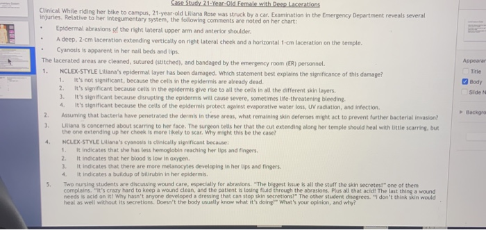 Side launch case study answers 08 picture