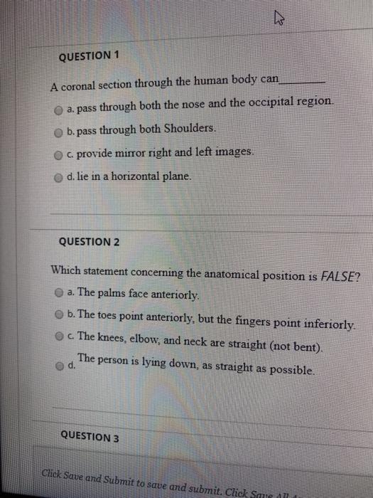 Solved QUESTION 1 A coronal section through the human body | Chegg.com