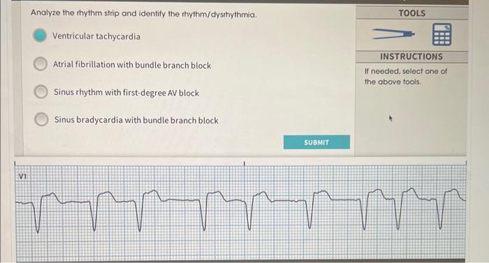 Solved Analyze the rhythm strip and identify the | Chegg.com