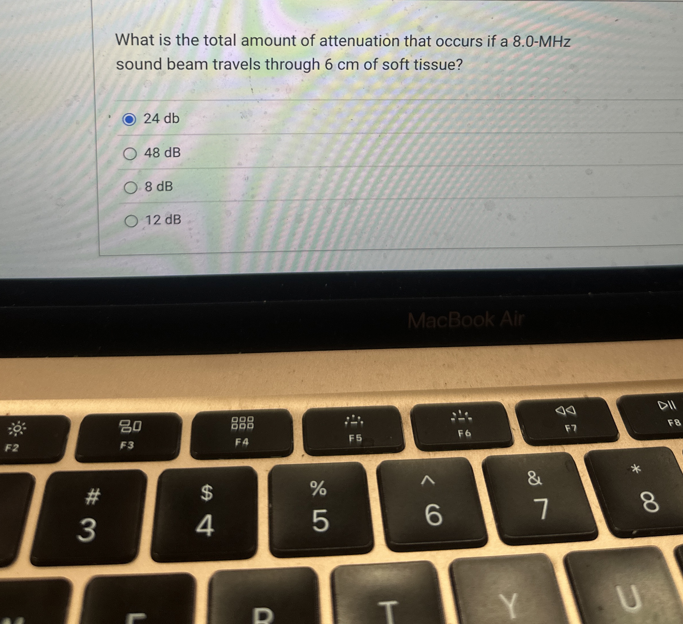 Solved What is the total amount of attenuation that occurs | Chegg.com