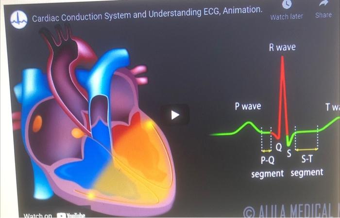 Solved Watch later Share Cardiac Conduction System and 