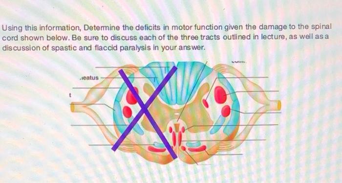 Solved Using this information, Determine the deficits in | Chegg.com