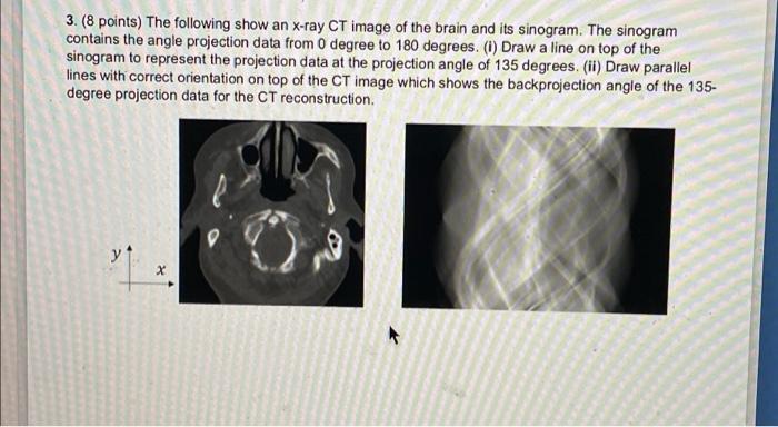 Points The Following Show An X Ray CT Image Of Chegg Com