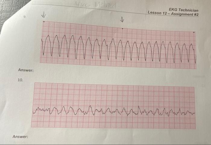 Solved Lesson 12 Assignment #2: Basic EKG Interpretation | Chegg.com