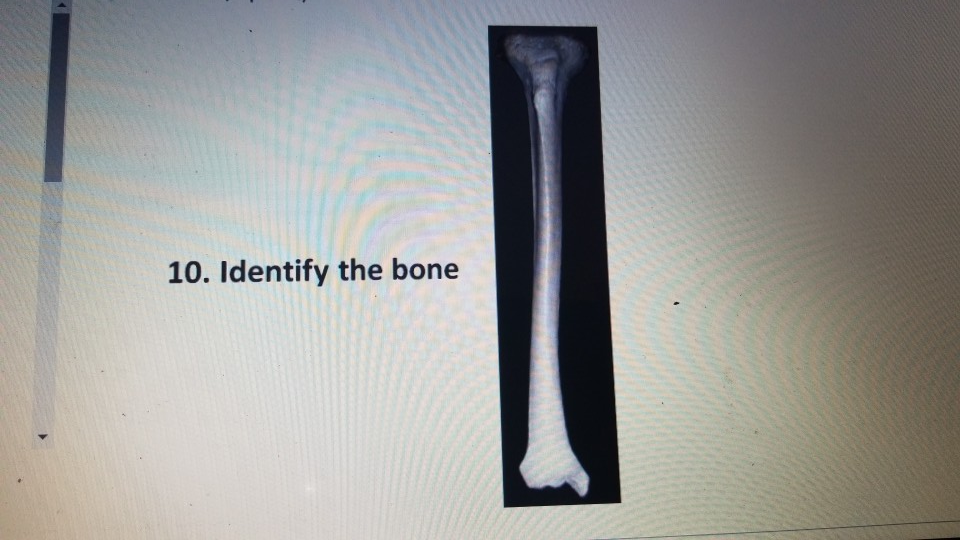 Solved 9. Identify the bone - 10. Identify the bone 11. | Chegg.com