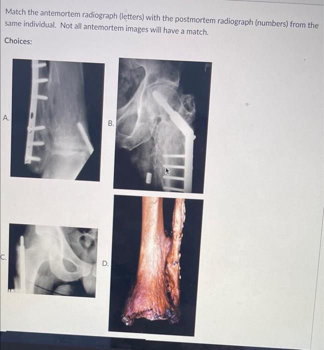 Match the antemortem radiograph (letters) with the | Chegg.com