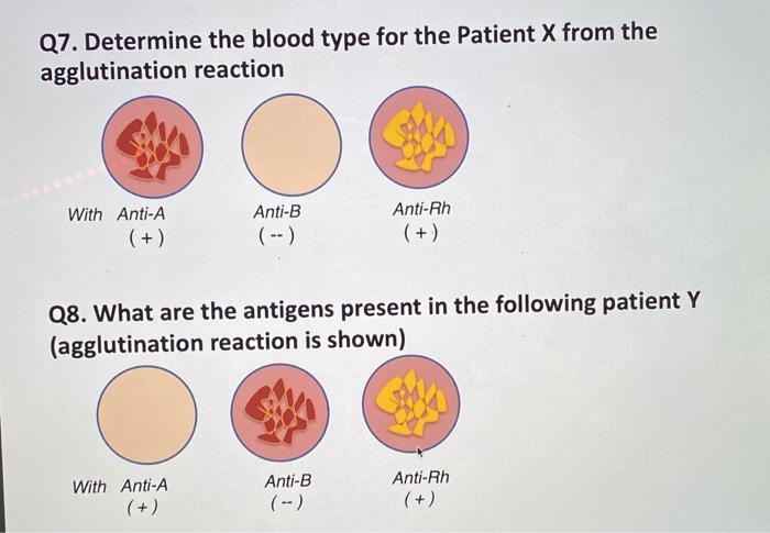 Solved Q7. Determine the blood type for the Patient X from | Chegg.com