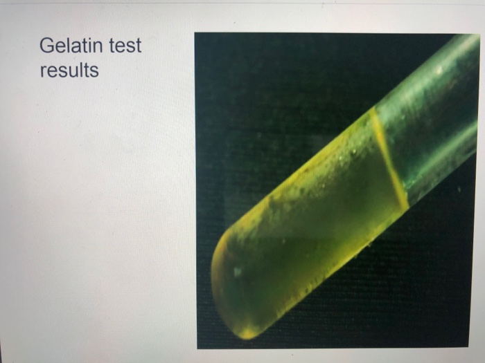 gelatin hydrolysis test reagent