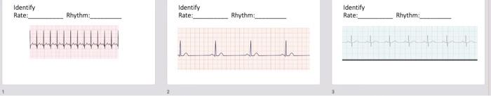 Solved Identify Rate: Identify Rate: Identify Rate: Rhythm: | Chegg.com