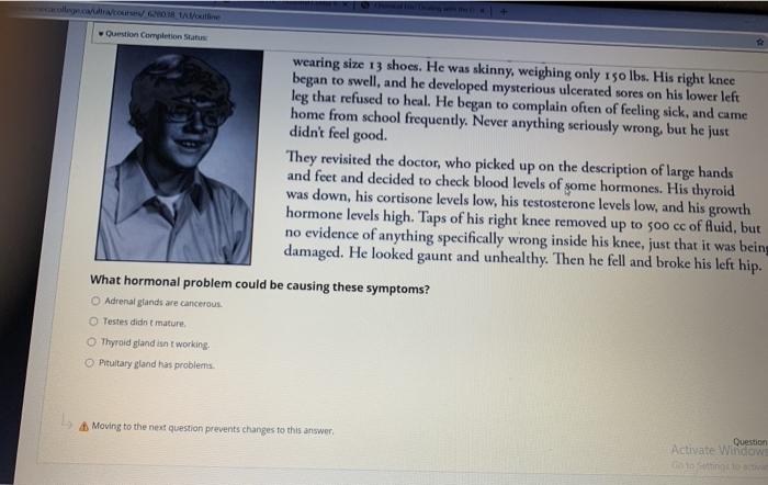 Question Completion Status wearing size 13 shoes. He was skinny, weighing only 150 lbs. His right knce began to swell, and he