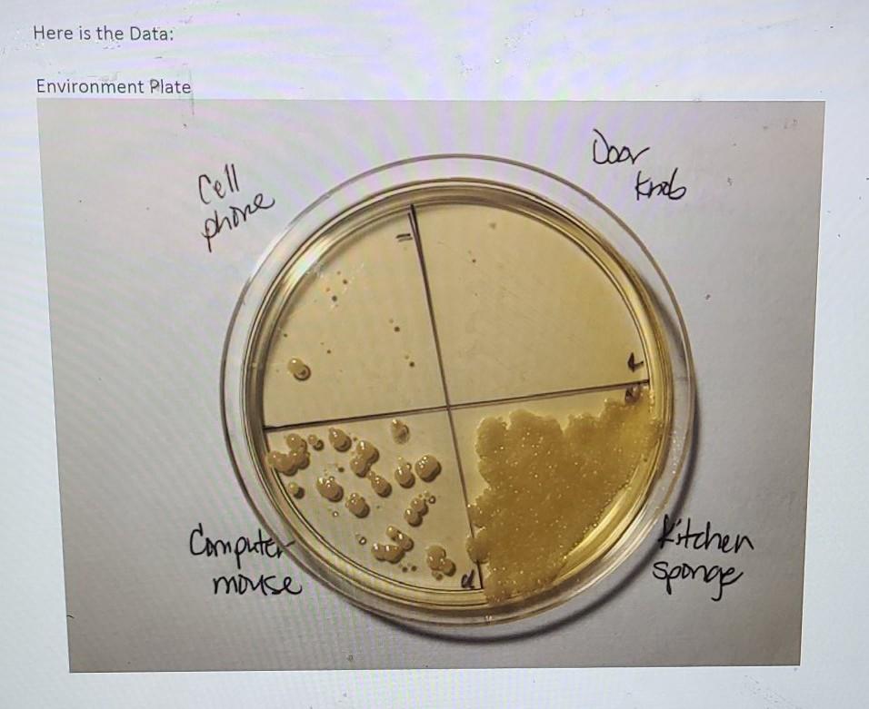 Solved Medium Large Small Pinpoint a. Size: Filamentous b. | Chegg.com