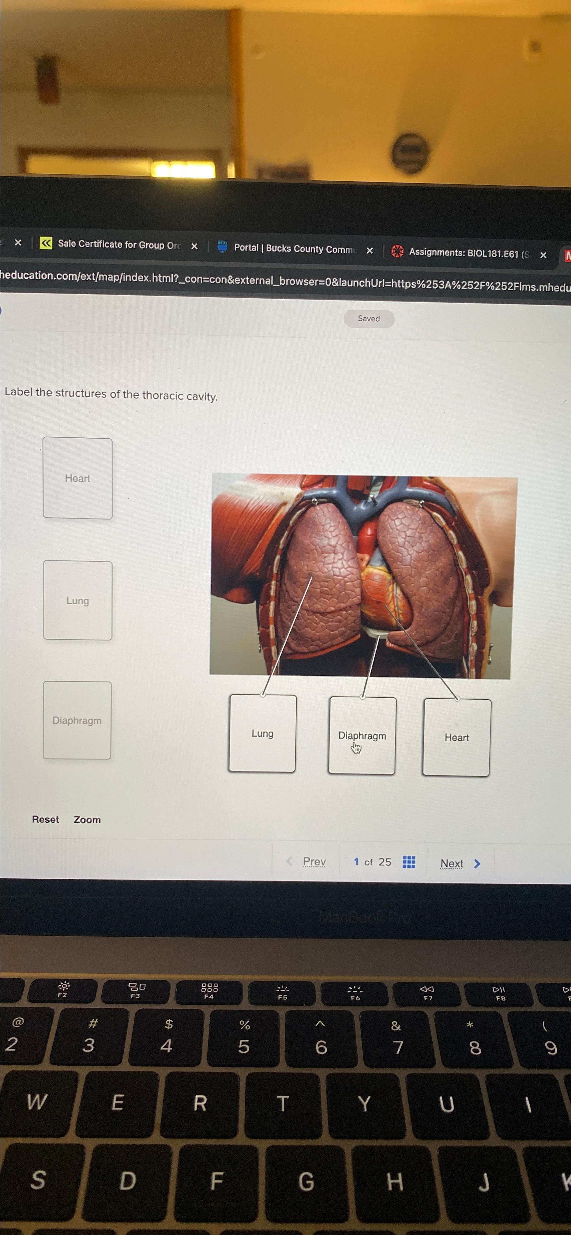 Solved Label the structures of the Abdominopelvic | Chegg.com