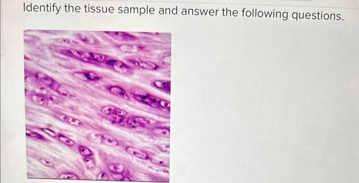 Solved Identify the tissue sample and answer the following | Chegg.com