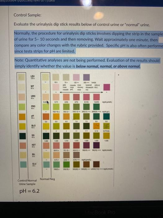 Solved Control Sample Evaluate the urinalysis dip stick