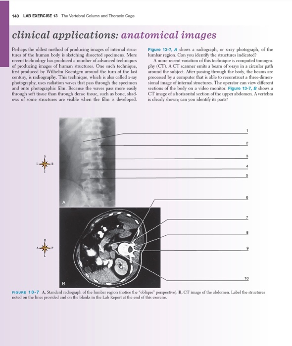 Solved 140 LAB EXERCISE 13 The Vertebral Column and Thoracic
