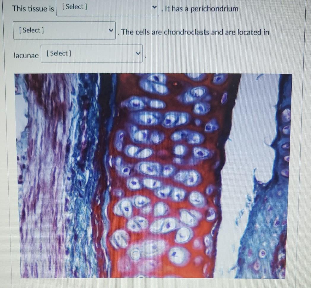 This tissue is [Select ] It has a perichondrium [ | Chegg.com