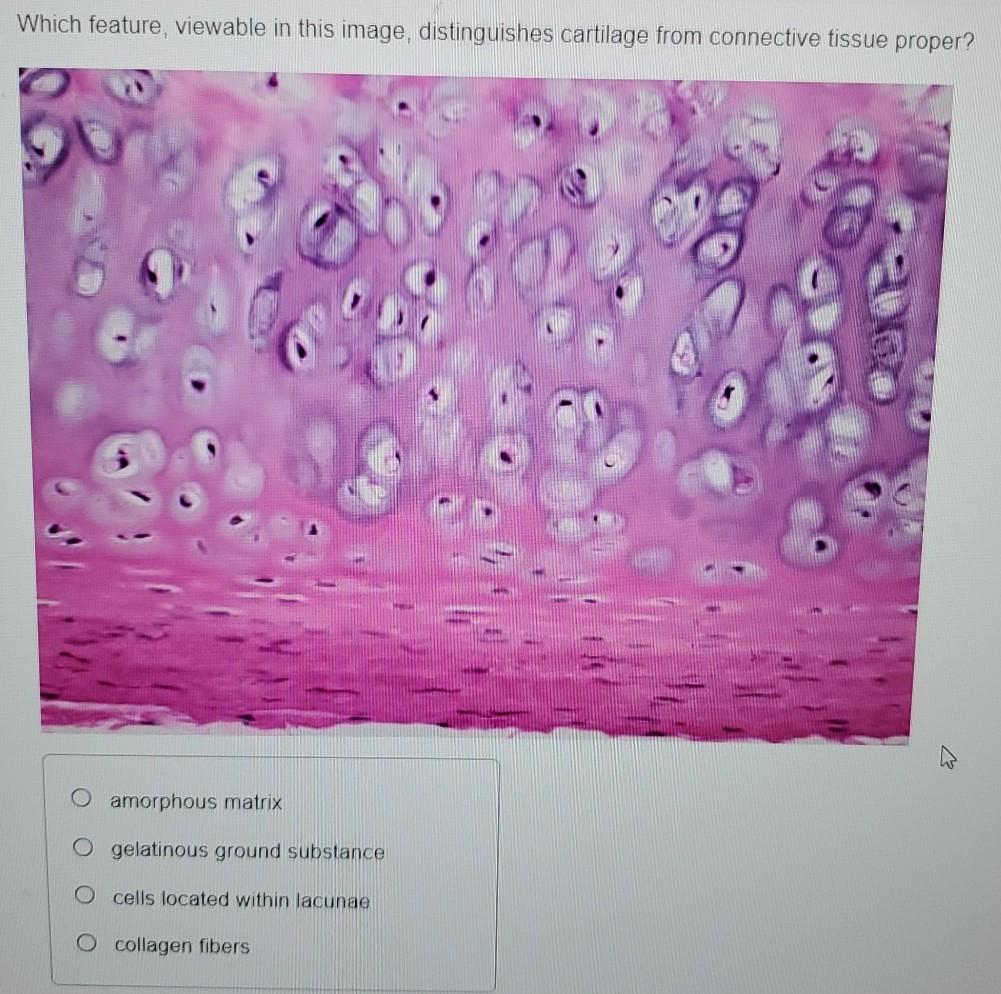 Solved Which feature, viewable in this image, distinguishes