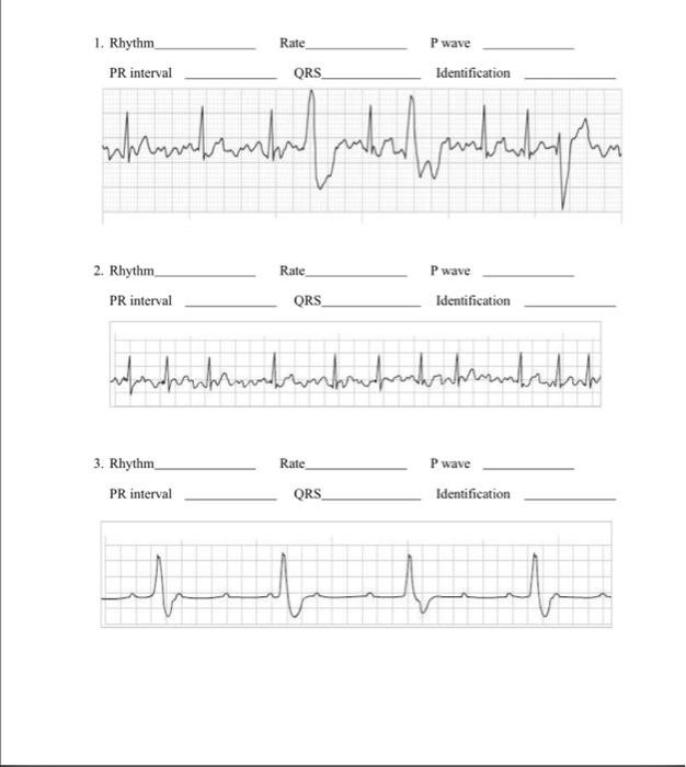 Solved 2. Rhythm PR interval Rate P wave QRS Identification | Chegg.com