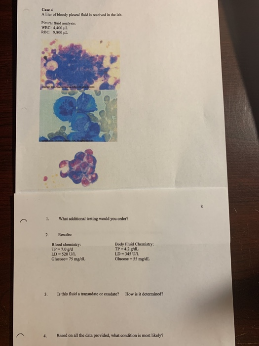 Solved Case A liter of bloody pleural fluid is received in