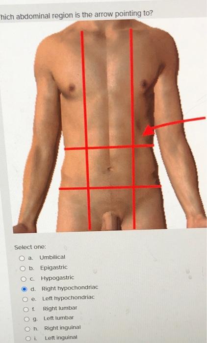 Solved Which body region is the arrow pointing to? Select