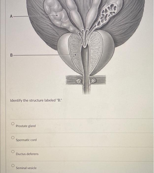 Identify the structure labeled B.
Prostate gland
Spermatic cord
Ductus deferens
Seminal vesicle