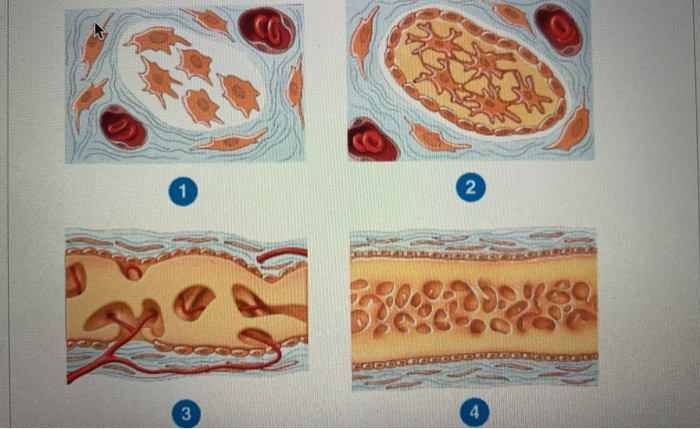 intramembranous ossification stages