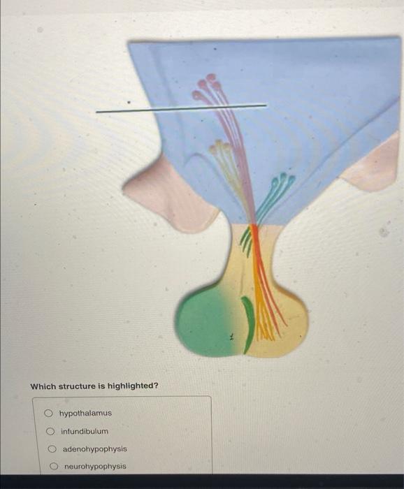 Solved Which structure is highlighted? Ohypothalamus | Chegg.com