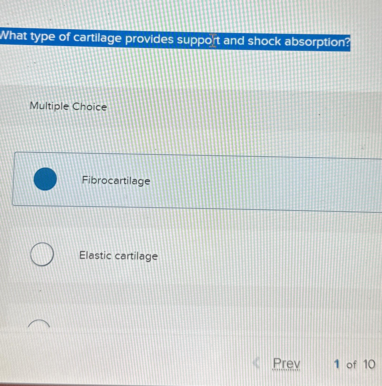 Solved What type of cartilage provides suppoit and shock