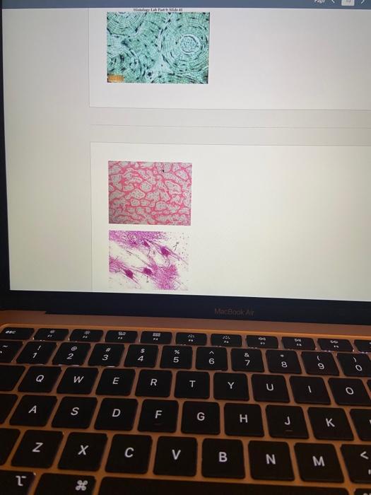 On each of the pictures indicate the tissue,