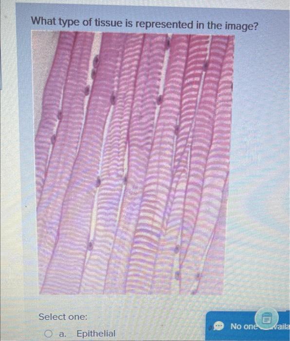 Solved What type of tissue is represented in the image?