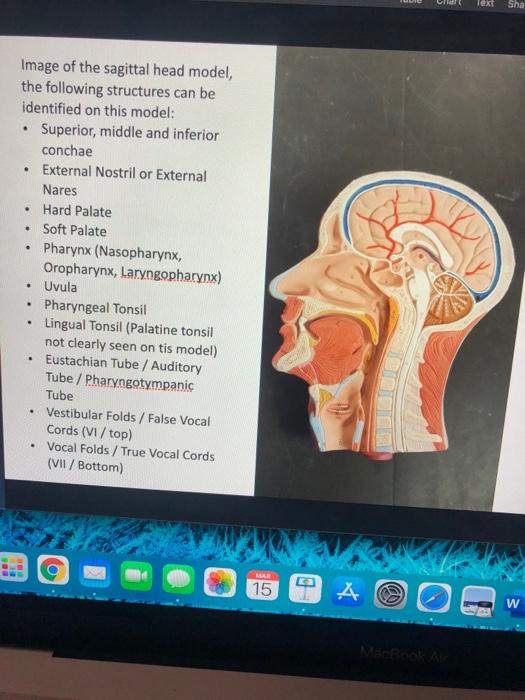 w Text Sha . . . Image of the sagittal head model, the following structures can be identified on this model: Superior, middle