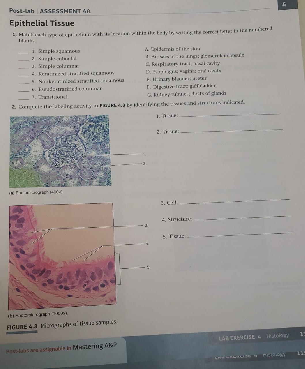 Post Lab Assessment 4a Epithelial Tissue 1 Match Chegg 