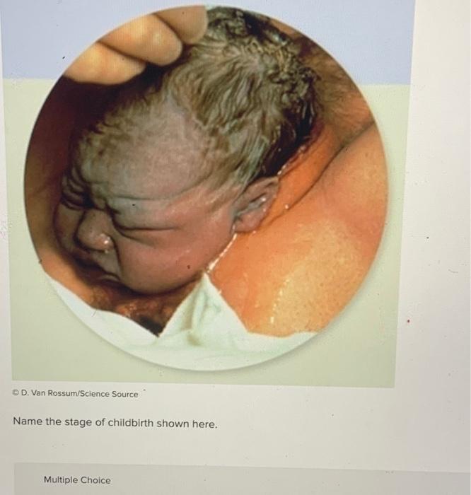 Name the stage of childbirth shown here.
Multiple Choice