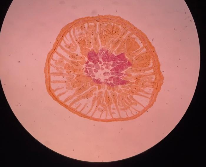 Solved Procedure Examine the “Metridium (c.s)" prepared | Chegg.com
