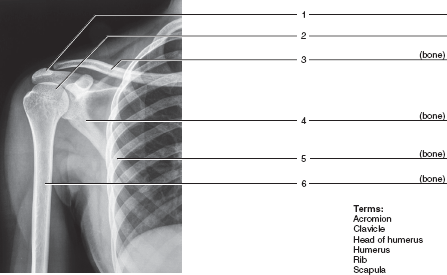 Solved: Identify the bones and features indicated in the radiog