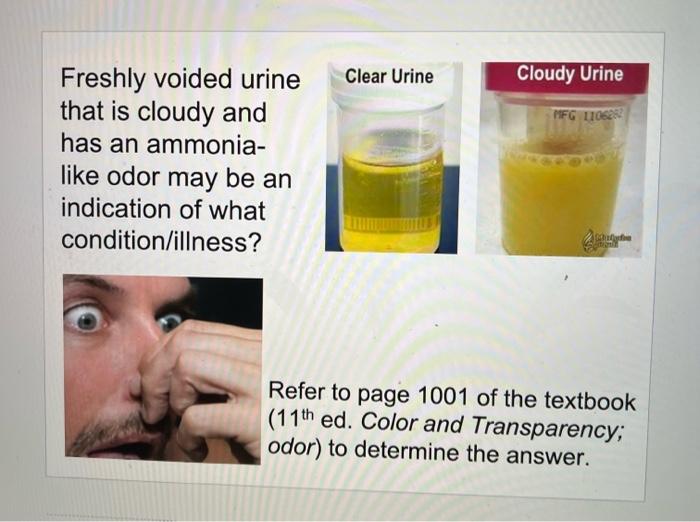 Cloudy Urine