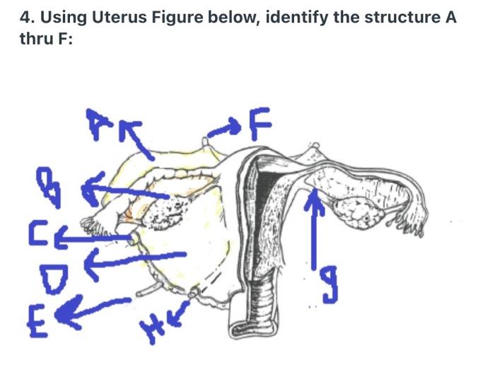 Solved 4. Using Uterus Figure below, identify the structure | Chegg.com