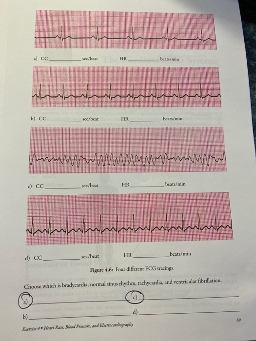 Solved AAAAA Label P. QRS, and Twaves on the ECG strip in | Chegg.com