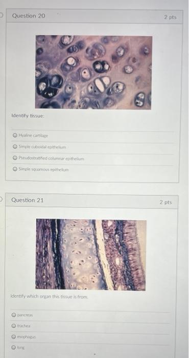 Solved Identify structure \#3 alveolar duct alveolar sac | Chegg.com