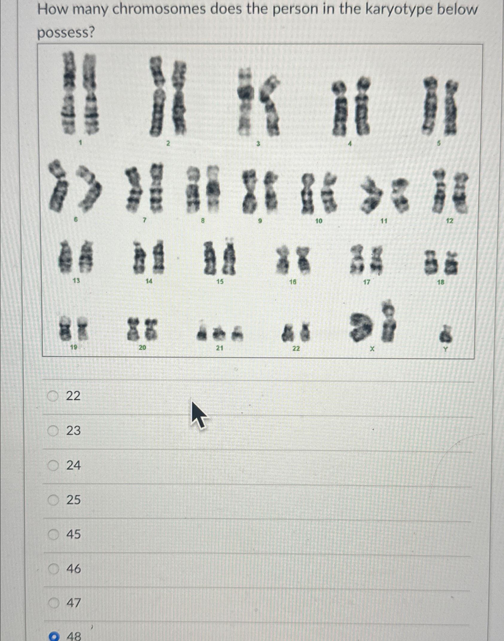 Solved How many chromosomes does the person in the karyotype | Chegg.com