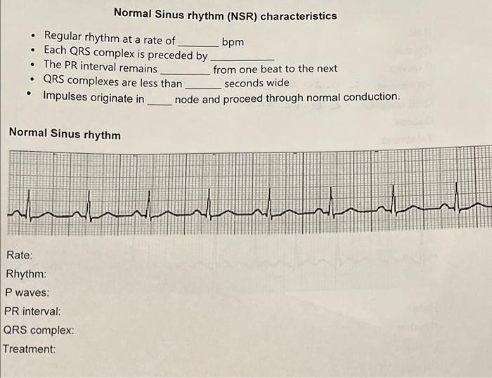 Normal Sinus rhythm (NSR) characteristics - Regular | Chegg.com | Chegg.com