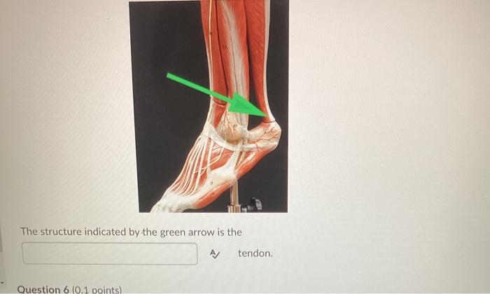 Solved The structure indicated by the green arrow is the A | Chegg.com