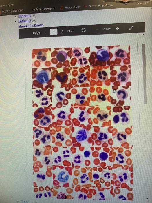 Solved Page 1 of 5 0 ZOOM + Case Study (Blood) Blood is | Chegg.com