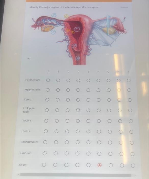 Solved Identify The Majof Organe Of The Female Reproductive | Chegg.com